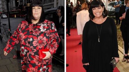 Dawn French needed undergo weight loss for her hysterectomy operation.